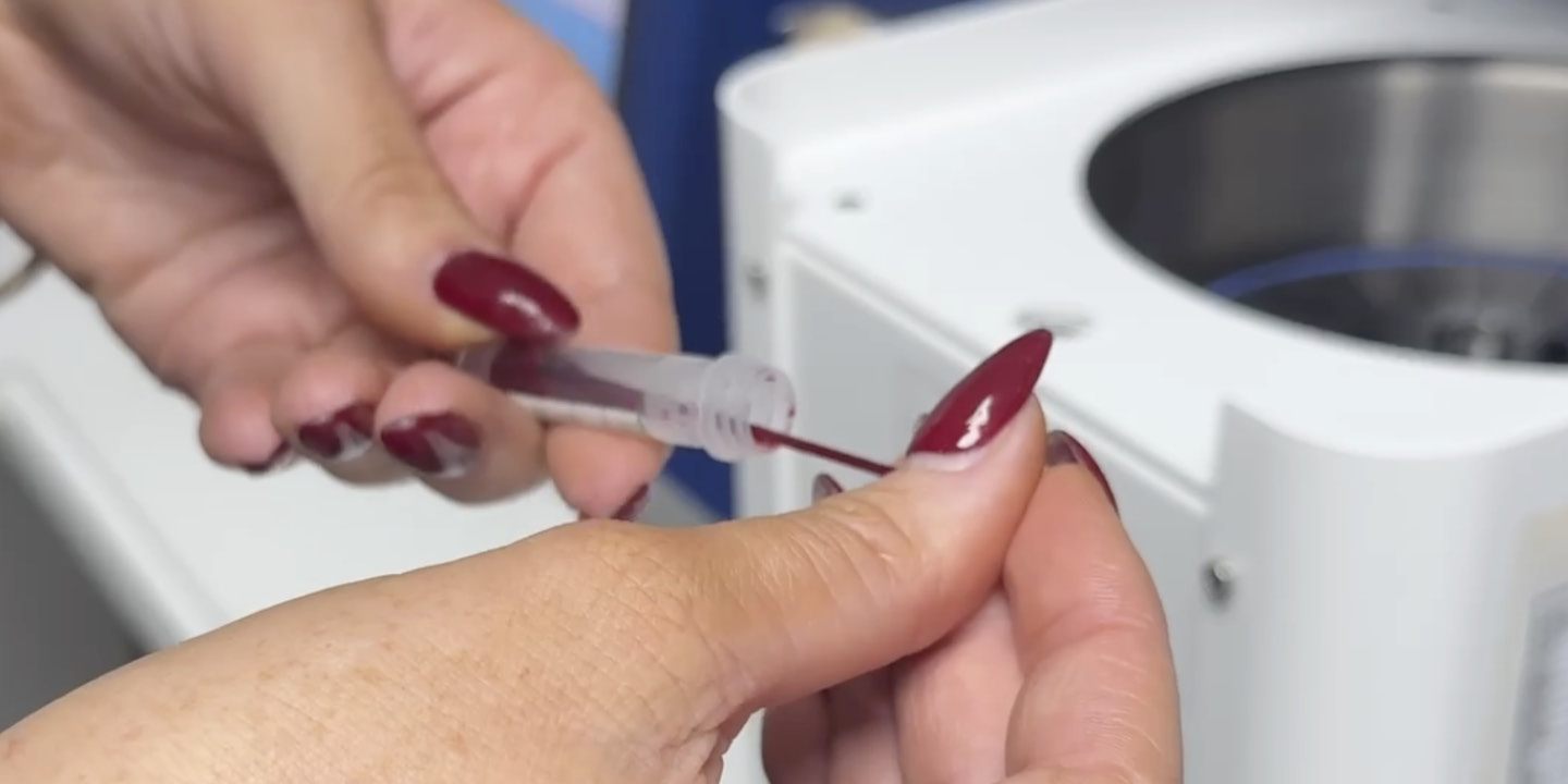 Blood tests and what they tell us